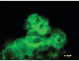 Anti-CALCR antibody produced in mousepurified immunoglobulin, buffered aqueous solution