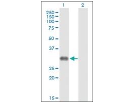 Anti-CD7 antibody produced in rabbitpurified immunoglobulin, buffered aqueous solution