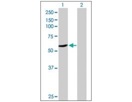 Anti-CYP2A6 antibody produced in rabbitpurified immunoglobulin, buffered aqueous solution