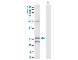 Anti-GJB5 antibody produced in rabbitpurified immunoglobulin, buffered aqueous solution