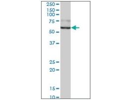 Anti-GUSB antibody produced in mousepurified immunoglobulin, buffered aqueous solution
