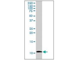 Anti-IAPP antibody produced in rabbitpurified immunoglobulin, buffered aqueous solution