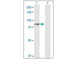 Anti-POLH antibody produced in rabbitpurified immunoglobulin, buffered aqueous solution