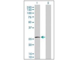 Anti-RAC3 antibody produced in rabbitpurified immunoglobulin, buffered aqueous solution
