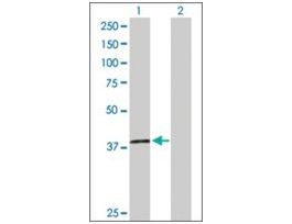 Anti-H2AFY2 antibody produced in rabbitpurified immunoglobulin, buffered aqueous solution
