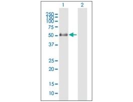 Anti-PNPLA3 antibody produced in mousepurified immunoglobulin, buffered aqueous solution