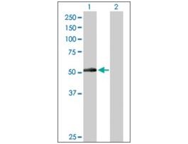 Anti-PNPLA3 antibody produced in rabbitpurified immunoglobulin, buffered aqueous solution