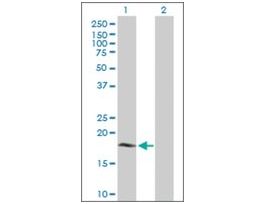 Anti-CYB5B antibody produced in mousepurified immunoglobulin, buffered aqueous solution