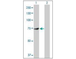Anti-DDX53 antibody produced in rabbitpurified immunoglobulin, buffered aqueous solution