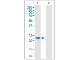 Anti-GPR110 antibody produced in mousepurified immunoglobulin, buffered aqueous solution