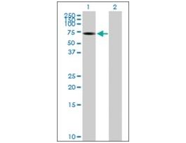 Anti-ALPPL2 antibody produced in mousepurified immunoglobulin, buffered aqueous solution