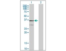 Anti-BDH1 antibody produced in mousepurified immunoglobulin, buffered aqueous solution