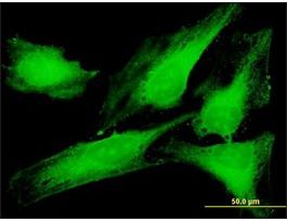 Anti-PTTG1IP antibody produced in mousepurified immunoglobulin, buffered aqueous solution