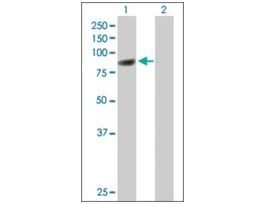 Anti-CBFA2T3 antibody produced in mousepurified immunoglobulin, buffered aqueous solution