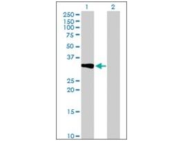 Anti-CRHBP antibody produced in mousepurified immunoglobulin, buffered aqueous solution