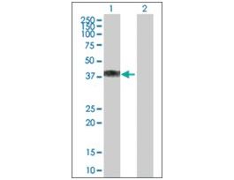 Anti-HAPLN1 antibody produced in mousepurified immunoglobulin, buffered aqueous solution