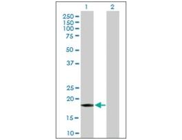 Anti-GADD45A antibody produced in mousepurified immunoglobulin, buffered aqueous solution