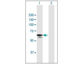 Anti-GBA antibody produced in mousepurified immunoglobulin, buffered aqueous solution