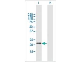 Anti-GM2A antibody produced in mousepurified immunoglobulin, buffered aqueous solution