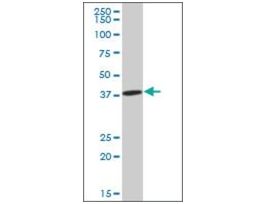Anti-IDH3A antibody produced in mousepurified immunoglobulin, buffered aqueous solution