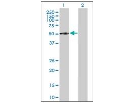 Anti-CFI antibody produced in mousepurified immunoglobulin, buffered aqueous solution