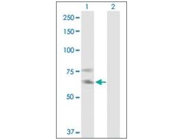 Anti-IL2RB antibody produced in mousepurified immunoglobulin, buffered aqueous solution