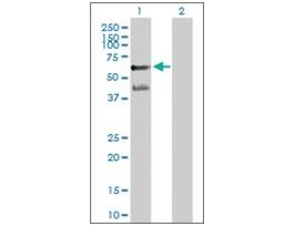 Anti-PPARA antibody produced in mousepurified immunoglobulin, buffered aqueous solution