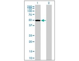 Anti-PTPN1 antibody produced in mousepurified immunoglobulin, buffered aqueous solution