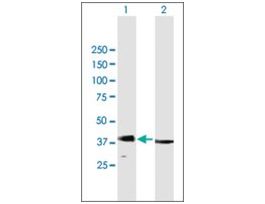 Anti-RAD51 antibody produced in mousepurified immunoglobulin, buffered aqueous solution