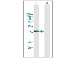 Anti-RBMY1A1 antibody produced in mousepurified immunoglobulin, buffered aqueous solution