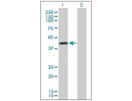 Anti-PTDSS1 antibody produced in mousepurified immunoglobulin, buffered aqueous solution