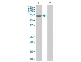 Anti-IKZF3 antibody produced in mousepurified immunoglobulin, buffered aqueous solution