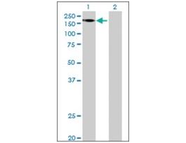 Anti-FRMPD1 antibody produced in mousepurified immunoglobulin, buffered aqueous solution