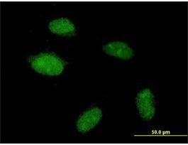Anti-POGZ antibody produced in mousepurified immunoglobulin, buffered aqueous solution