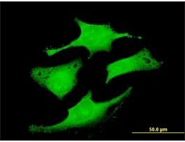 Anti-RAB6IP1 antibody produced in mousepurified immunoglobulin, buffered aqueous solution