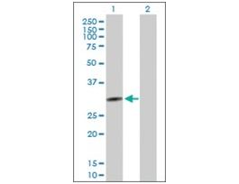Anti-QPCTL antibody produced in mousepurified immunoglobulin, buffered aqueous solution