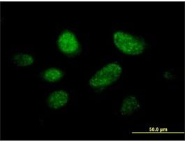 Anti-C14ORF106 antibody produced in mousepurified immunoglobulin, buffered aqueous solution