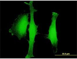 Anti-AGBL5 antibody produced in mousepurified immunoglobulin, buffered aqueous solution