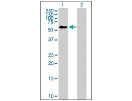 Anti-FRMD8 antibody produced in mousepurified immunoglobulin, buffered aqueous solution