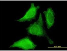 Anti-PROK1 antibody produced in mousepurified immunoglobulin, buffered aqueous solution