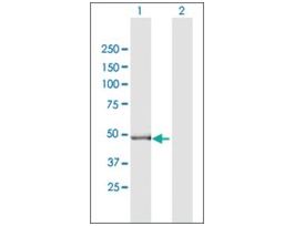 Anti-GPT2 antibody produced in mousepurified immunoglobulin, buffered aqueous solution