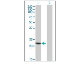Anti-RAB7B antibody produced in mousepurified immunoglobulin, buffered aqueous solution