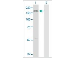 Anti-COL3A1 antibody produced in rabbitpurified immunoglobulin, buffered aqueous solution