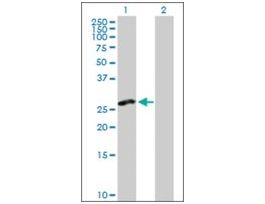 Anti-CLEC2D antibody produced in rabbitpurified immunoglobulin, buffered aqueous solution