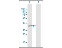 Anti-GPR146 antibody produced in rabbitpurified immunoglobulin, buffered aqueous solution