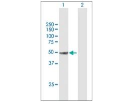 Anti-CUGBP1 antibody produced in mousepurified immunoglobulin, buffered aqueous solution