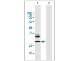 Anti-RAET1E antibody produced in mousepurified immunoglobulin, buffered aqueous solution