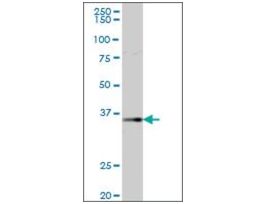 Anti-AKR1B1 antibody produced in mousepurified immunoglobulin, buffered aqueous solution