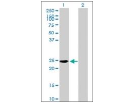Anti-RAB39 antibody produced in mousepurified immunoglobulin, buffered aqueous solution