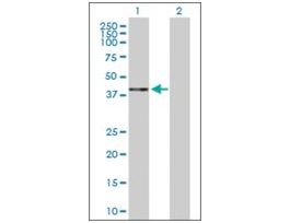 Anti-HAPLN1 antibody produced in rabbitpurified immunoglobulin, buffered aqueous solution